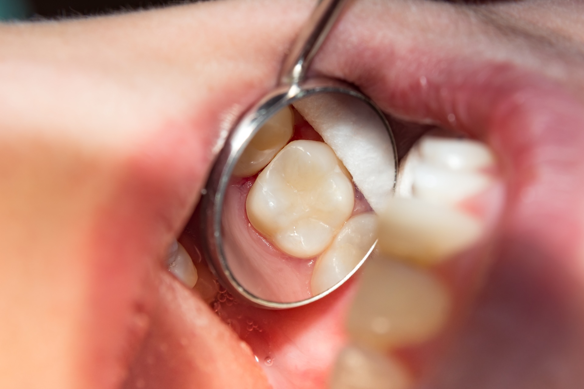 Patient at New Haven Family Dental